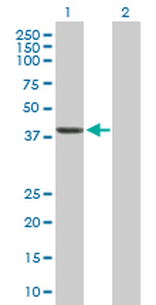 SEPT1 Antibody in Western Blot (WB)