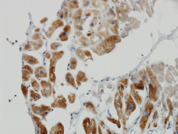 DLD Antibody in Immunohistochemistry (Paraffin) (IHC (P))