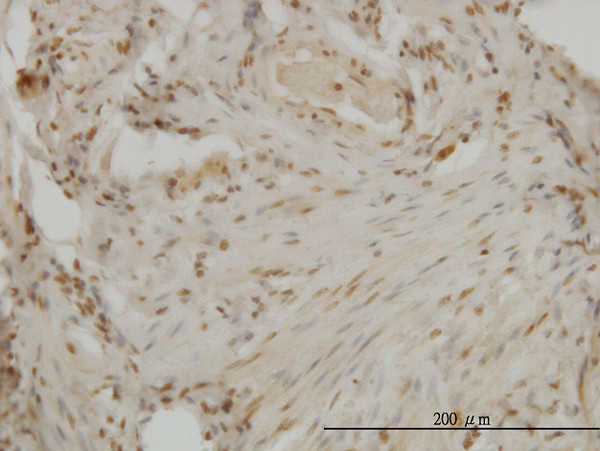 DLX2 Antibody in Immunohistochemistry (Paraffin) (IHC (P))