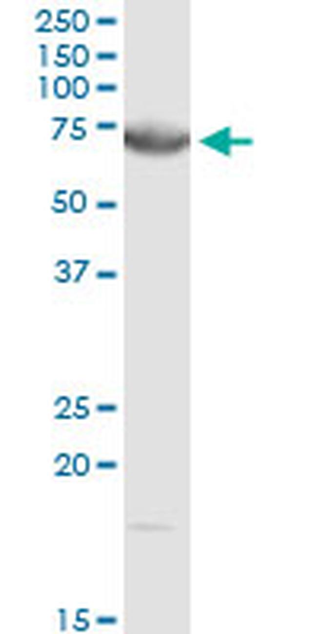 DMPK Antibody in Western Blot (WB)