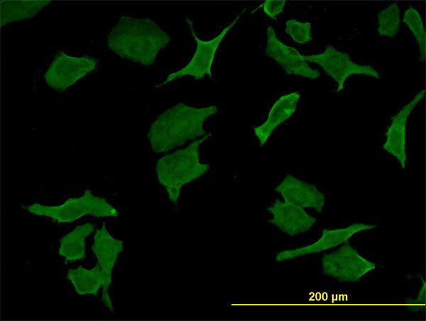 DPYD Antibody in Immunocytochemistry (ICC/IF)