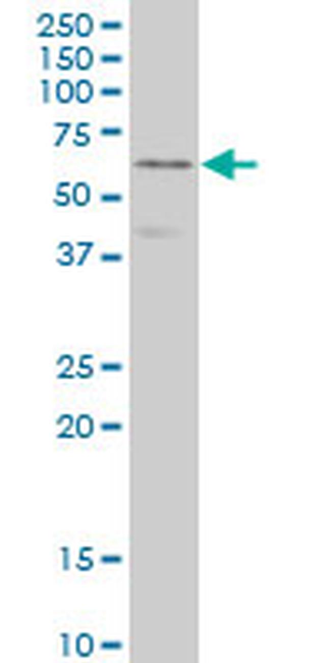 DPYSL3 Antibody in Western Blot (WB)