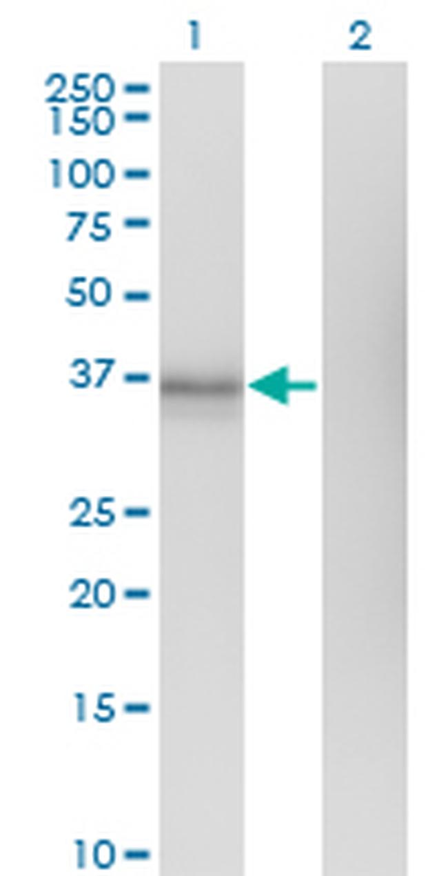 EDG1 Antibody in Western Blot (WB)