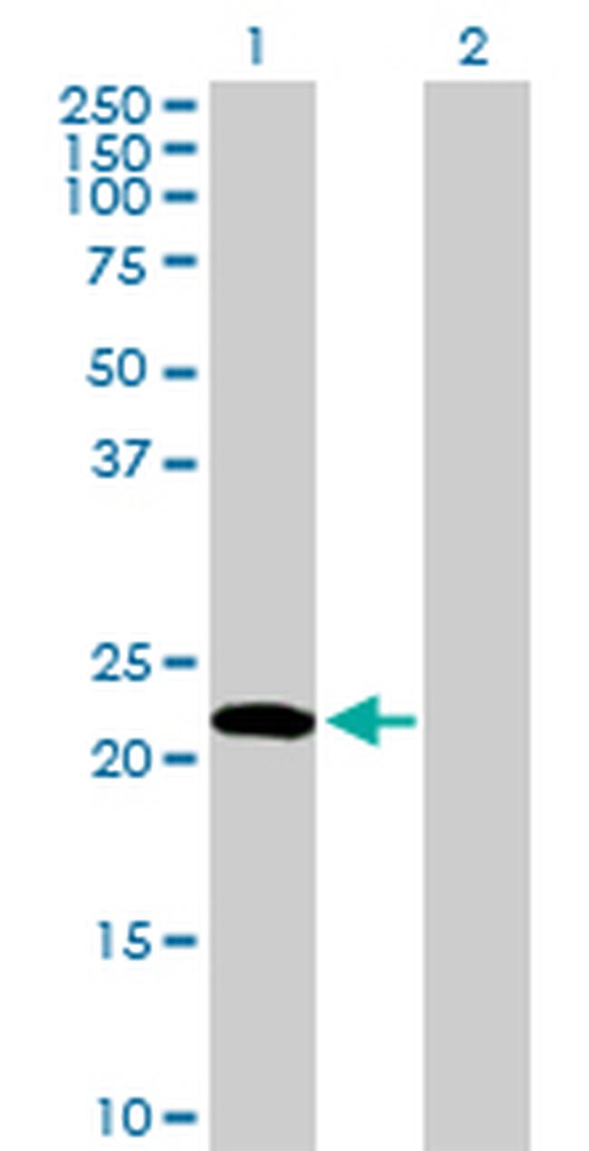 EDN1 Antibody in Western Blot (WB)