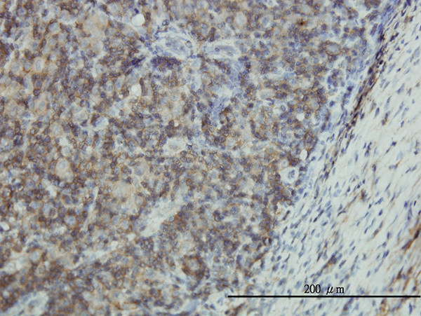 EMP3 Antibody in Immunohistochemistry (Paraffin) (IHC (P))