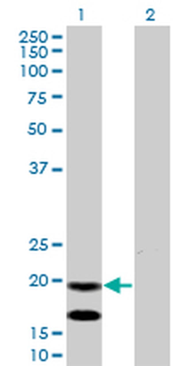 EMP3 Antibody in Western Blot (WB)