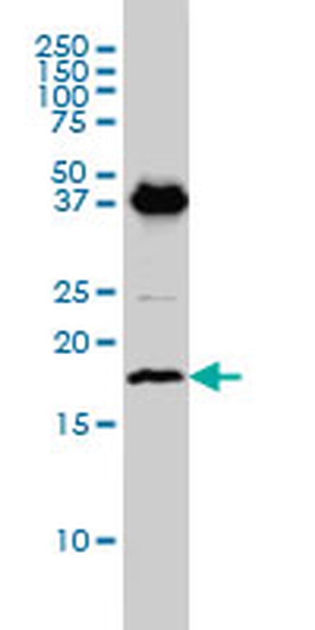 EMP3 Antibody in Western Blot (WB)