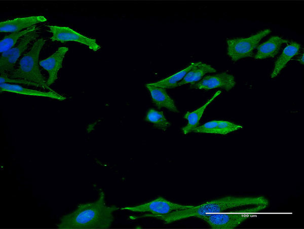 EN2 Antibody in Immunocytochemistry (ICC/IF)