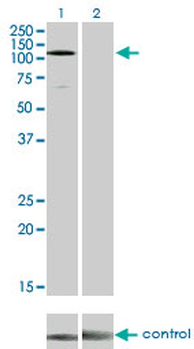 EPHA3 Antibody in Western Blot (WB)