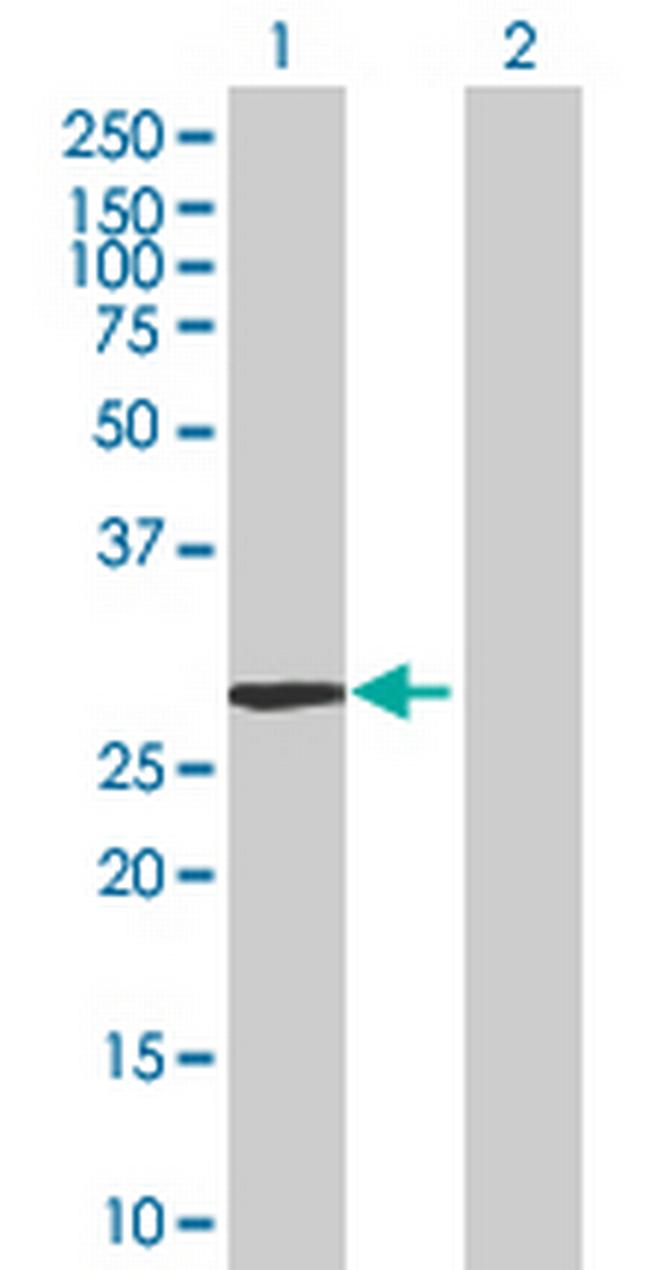 EPHA7 Antibody in Western Blot (WB)