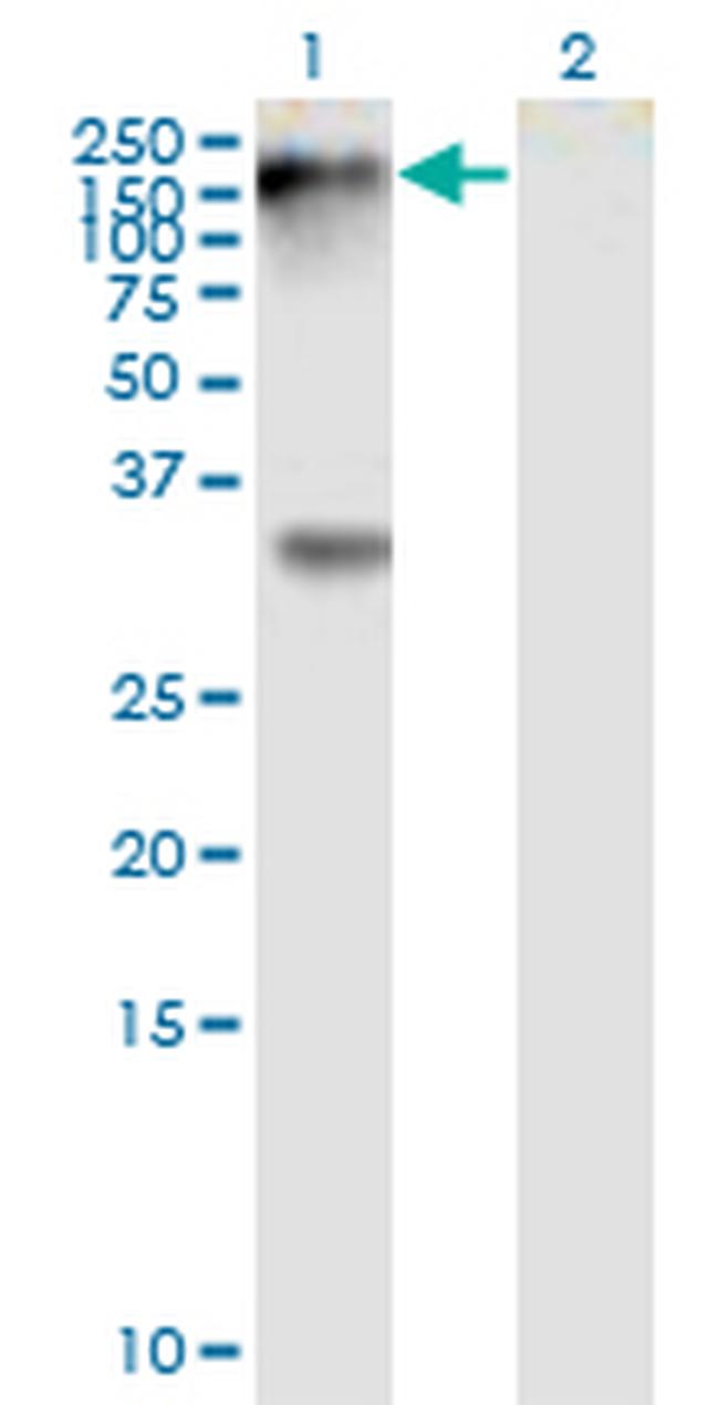 EPHB1 Antibody in Western Blot (WB)