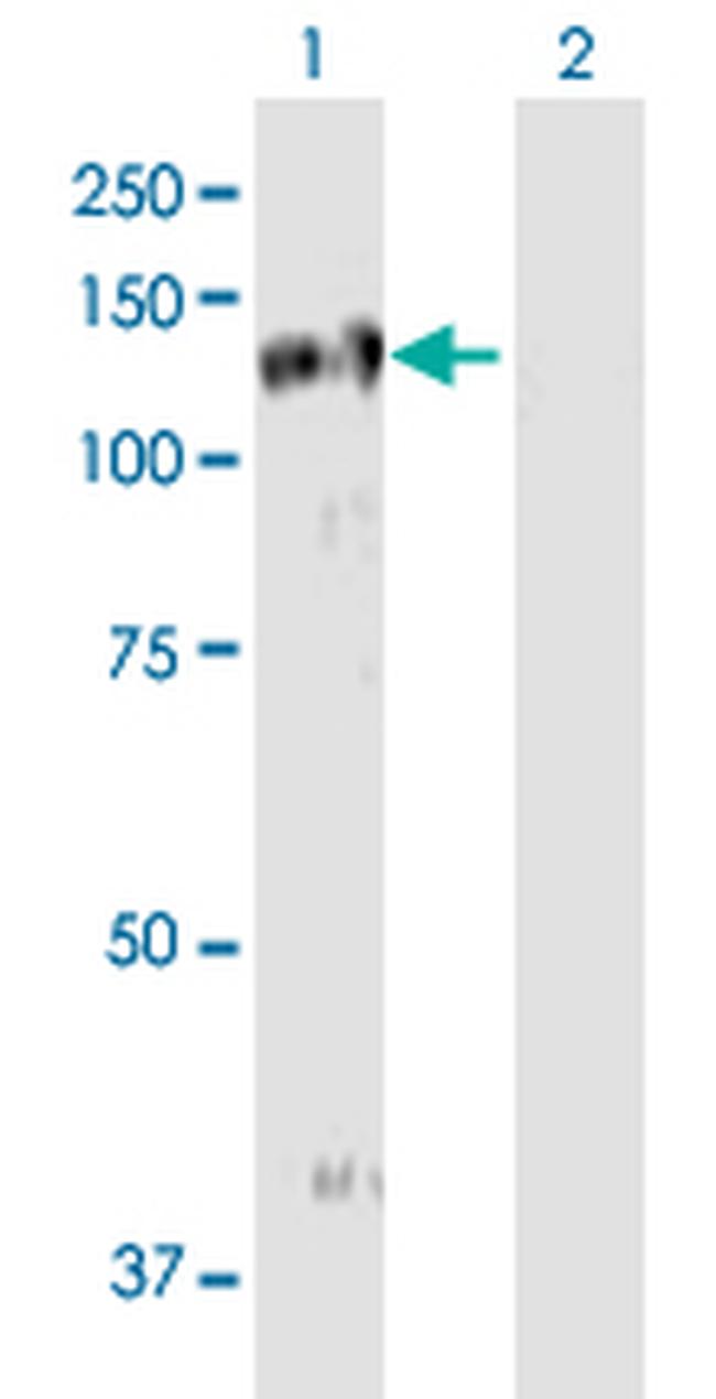 EPHB3 Antibody in Western Blot (WB)