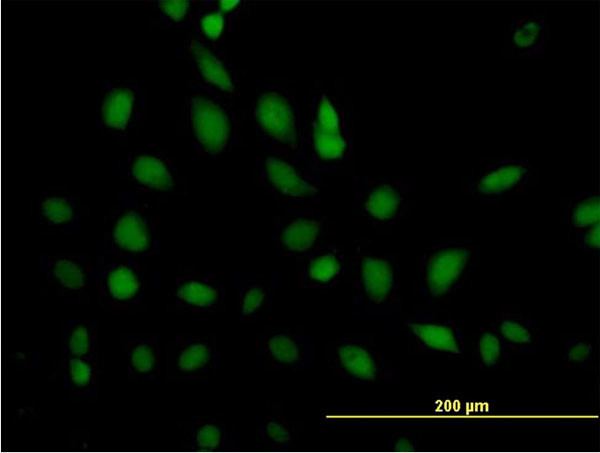 ERCC2 Antibody in Immunocytochemistry (ICC/IF)