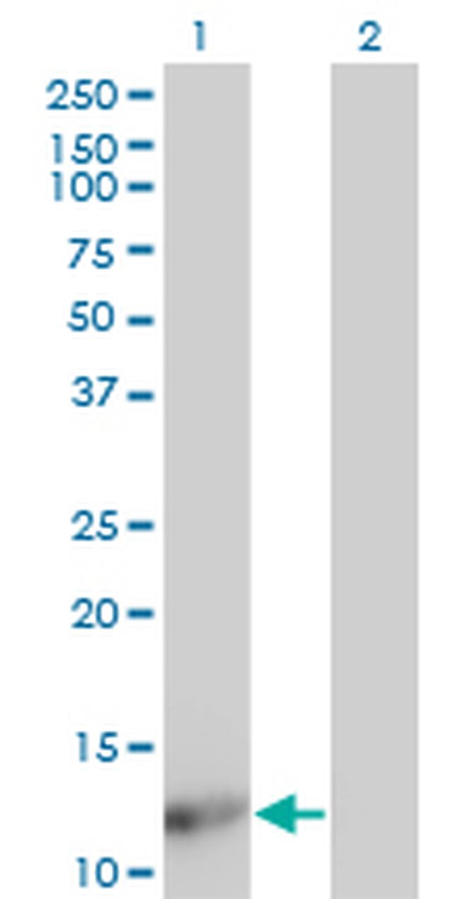 FABP4 Antibody in Western Blot (WB)