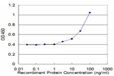 FAH Antibody in ELISA (ELISA)