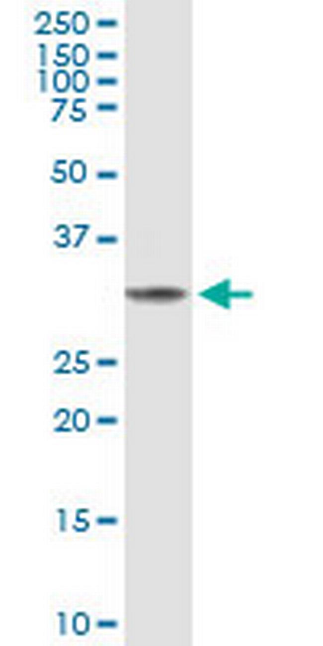 FBP1 Antibody in Western Blot (WB)