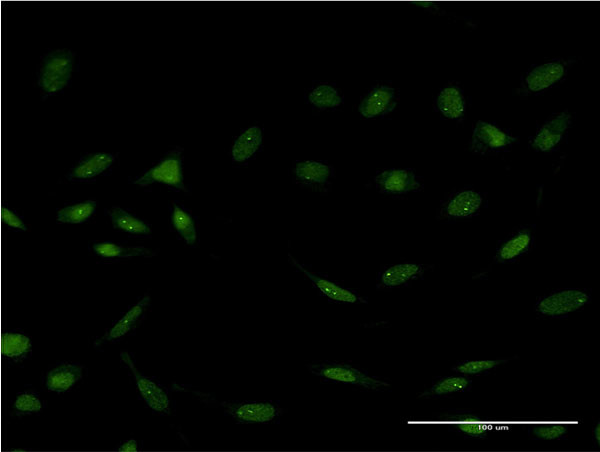 FOXC2 Antibody in Immunocytochemistry (ICC/IF)