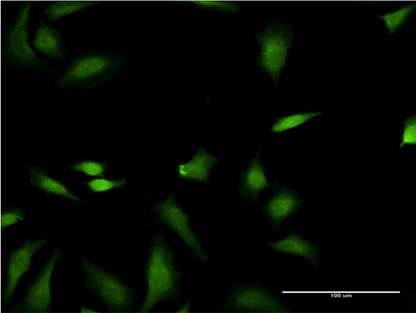 FNTB Antibody in Immunocytochemistry (ICC/IF)