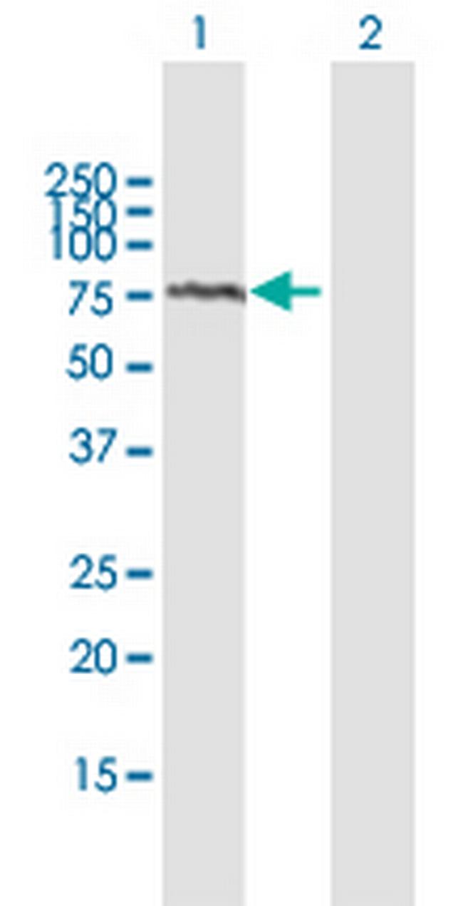 ADAM2 Antibody in Western Blot (WB)