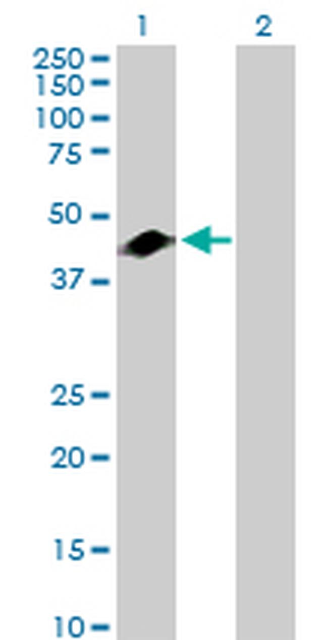 GART Antibody in Western Blot (WB)