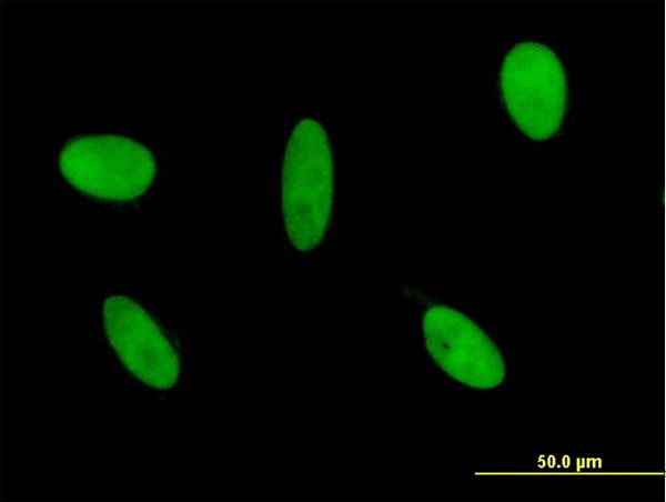 GLI3 Antibody in Immunocytochemistry (ICC/IF)