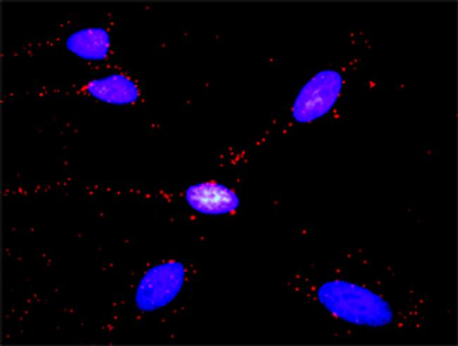 GLI3 Antibody in Proximity Ligation Assay (PLA) (PLA)