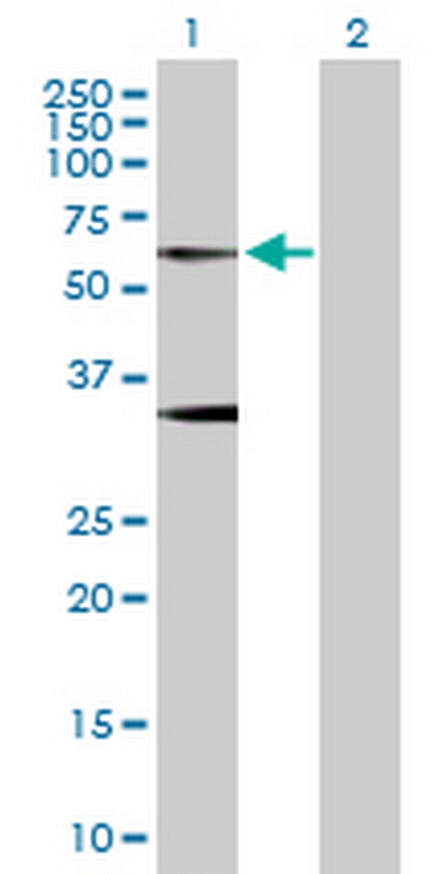 GLRA1 Antibody in Western Blot (WB)