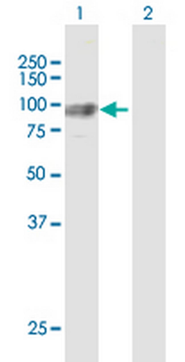 GNS Antibody in Western Blot (WB)