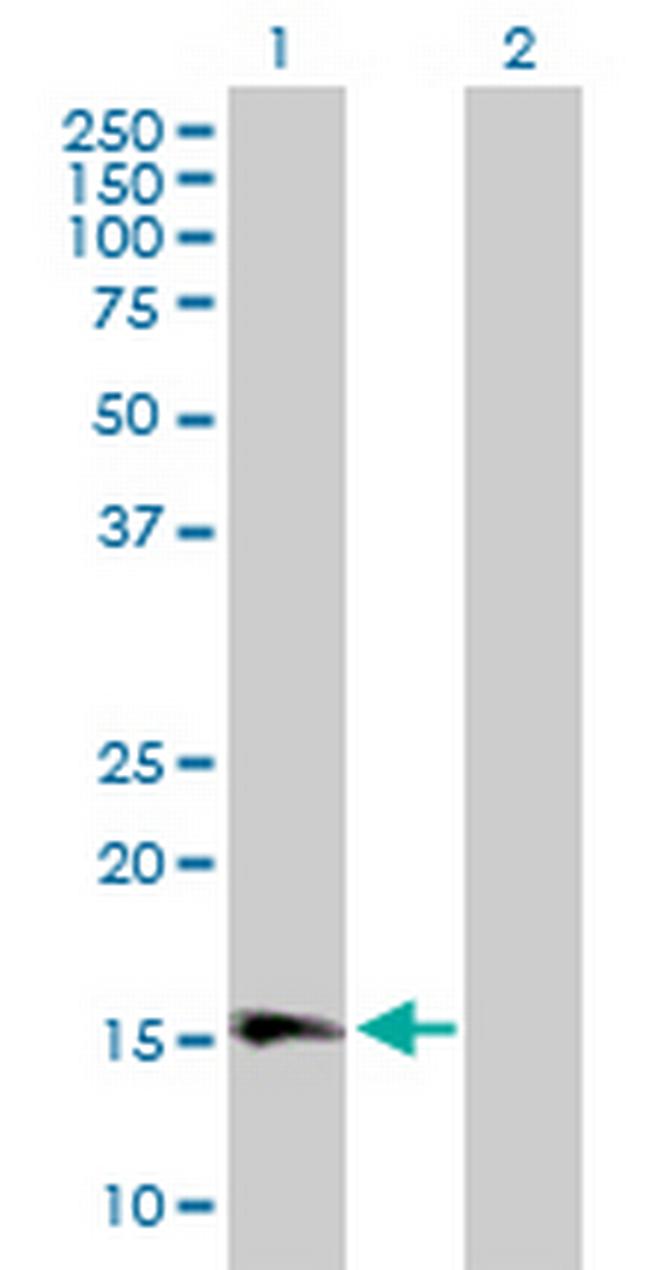 GPLD1 Antibody in Western Blot (WB)