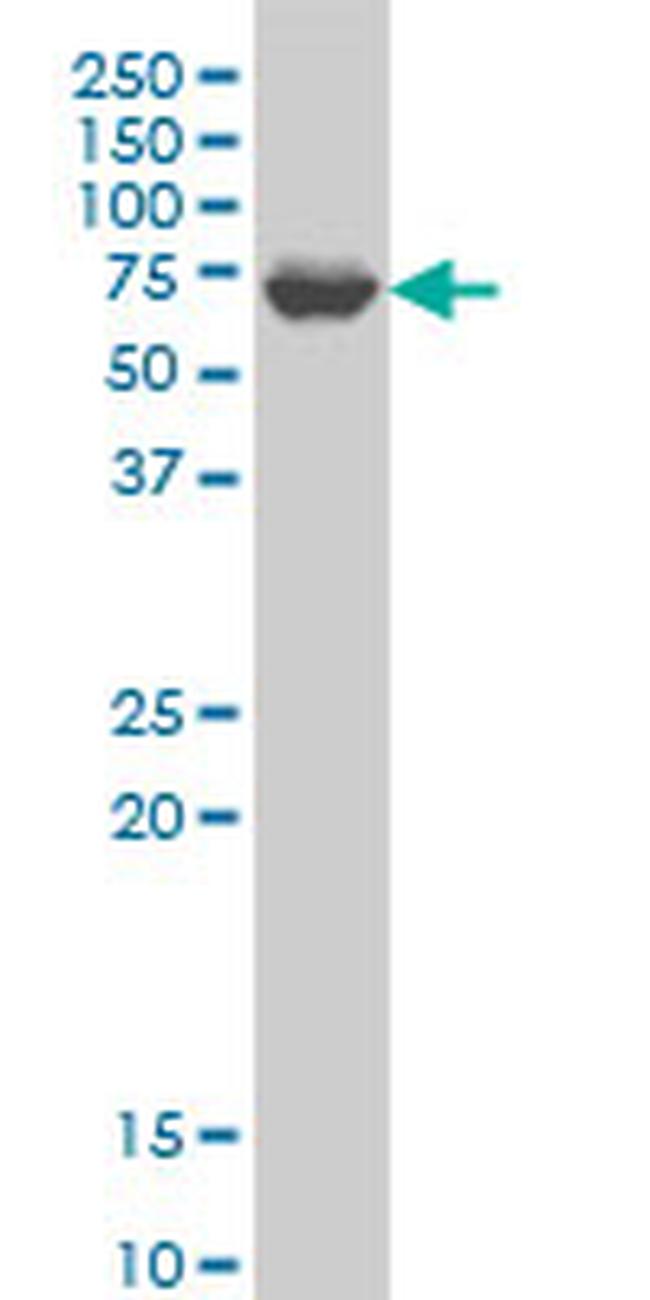 GRK6 Antibody in Western Blot (WB)