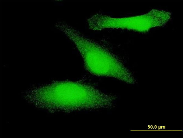 GSK3B Antibody in Immunocytochemistry (ICC/IF)