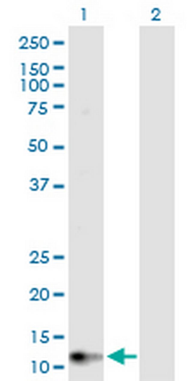 GUCA2B Antibody in Western Blot (WB)