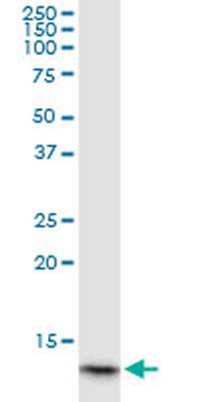 HBA1 Antibody in Western Blot (WB)