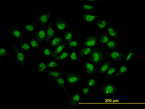 HDAC1 Antibody in Immunocytochemistry (ICC/IF)