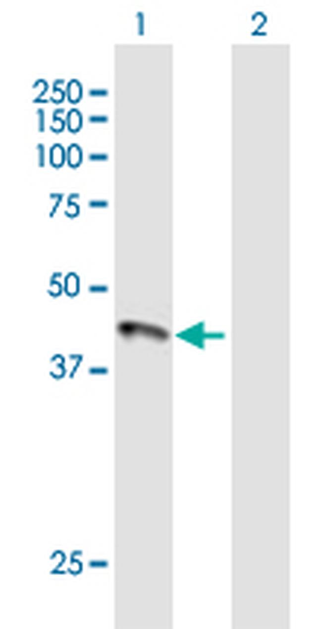 HFE Antibody in Western Blot (WB)