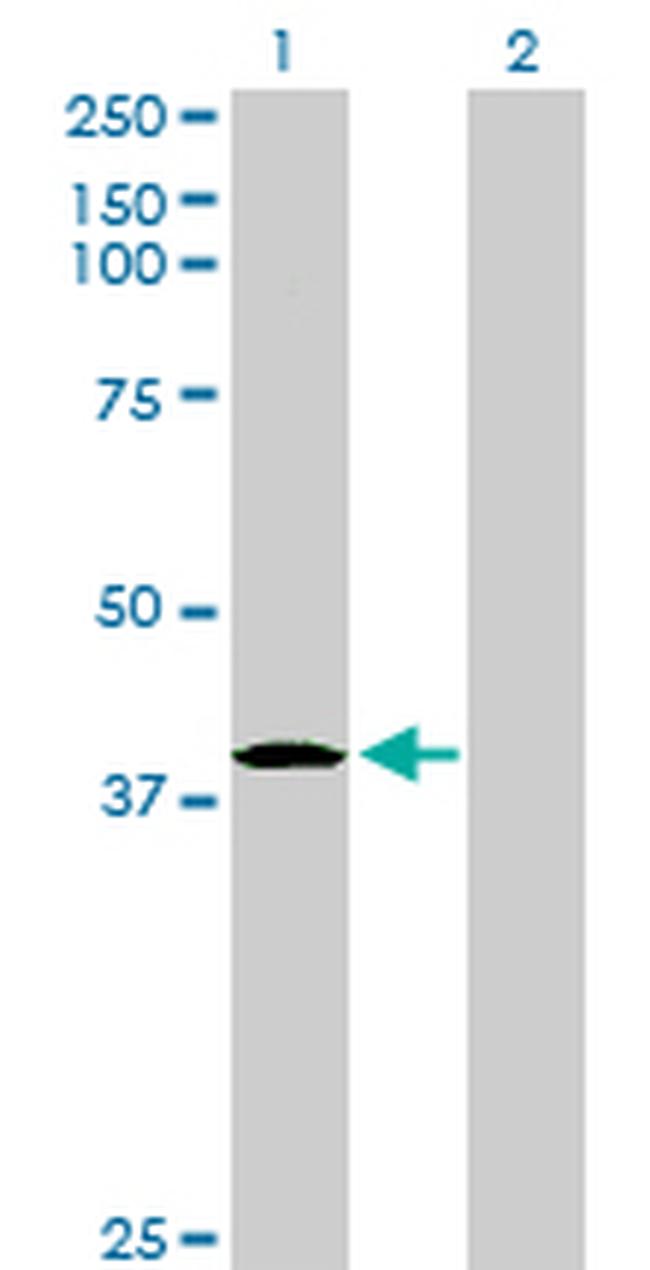 HHEX Antibody in Western Blot (WB)