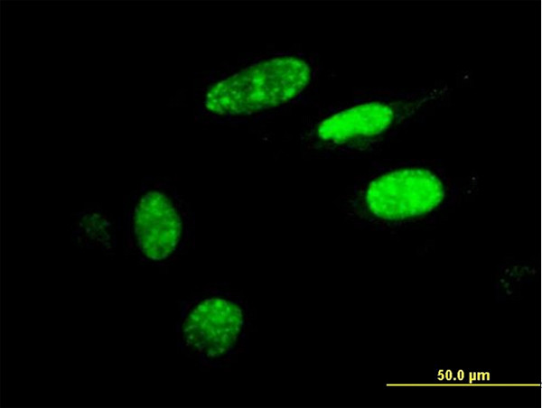 HIC1 Antibody in Immunocytochemistry (ICC/IF)