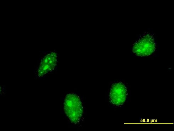 HIC1 Antibody in Immunocytochemistry (ICC/IF)