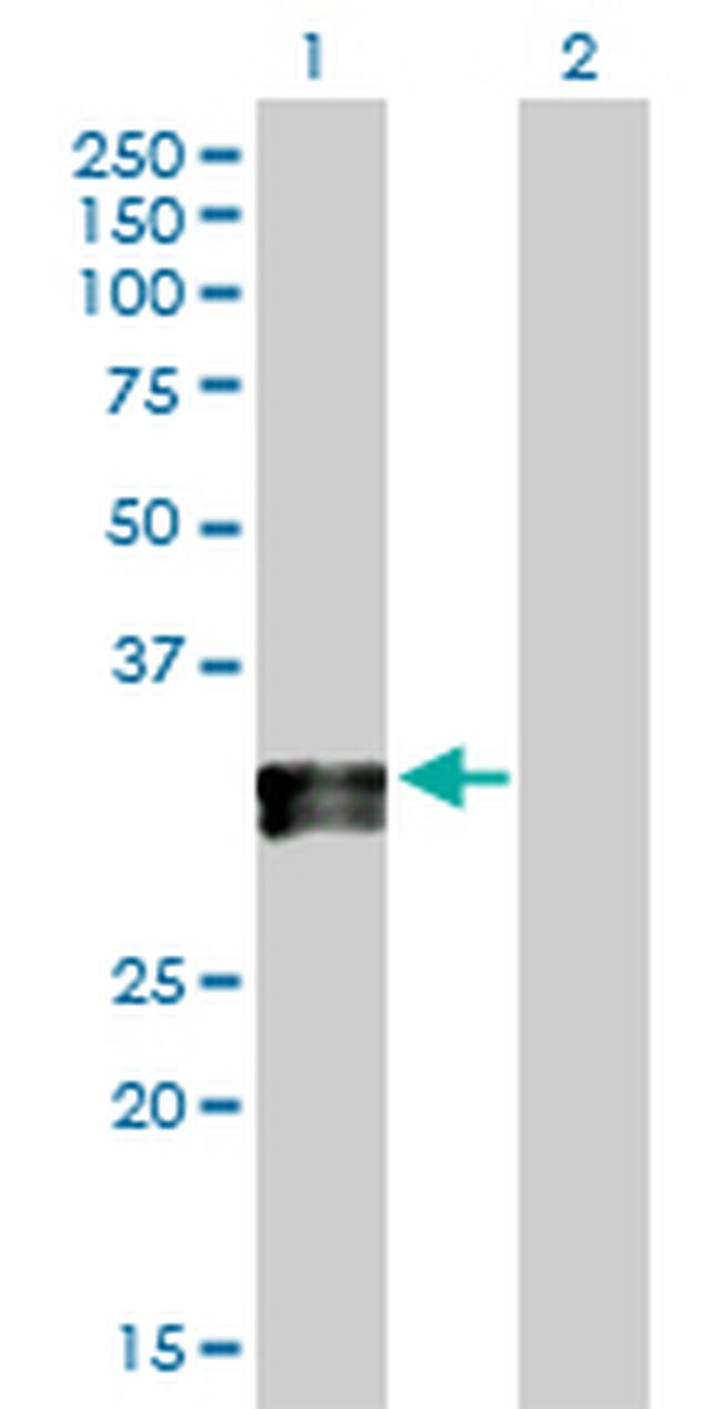 HLA-DPA1 Antibody in Western Blot (WB)