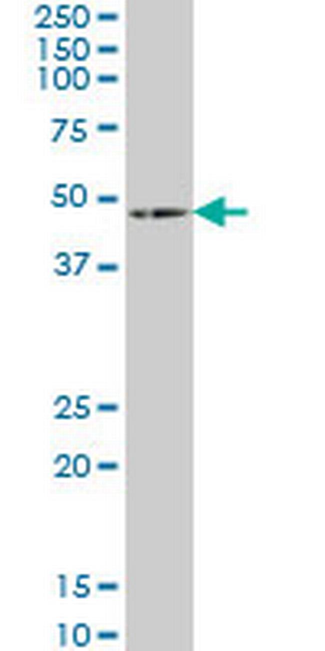 HOXA5 Antibody in Western Blot (WB)