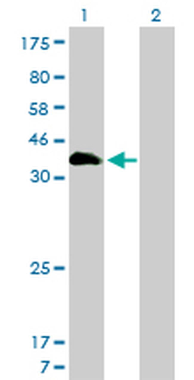 HOXA11 Antibody in Western Blot (WB)