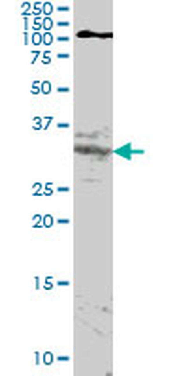 HOXA11 Antibody in Western Blot (WB)