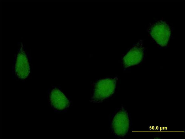 HOXB7 Antibody in Immunocytochemistry (ICC/IF)