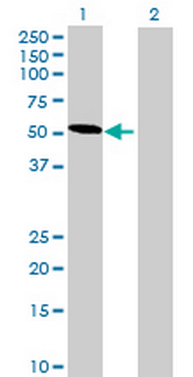 HSF4 Antibody in Western Blot (WB)