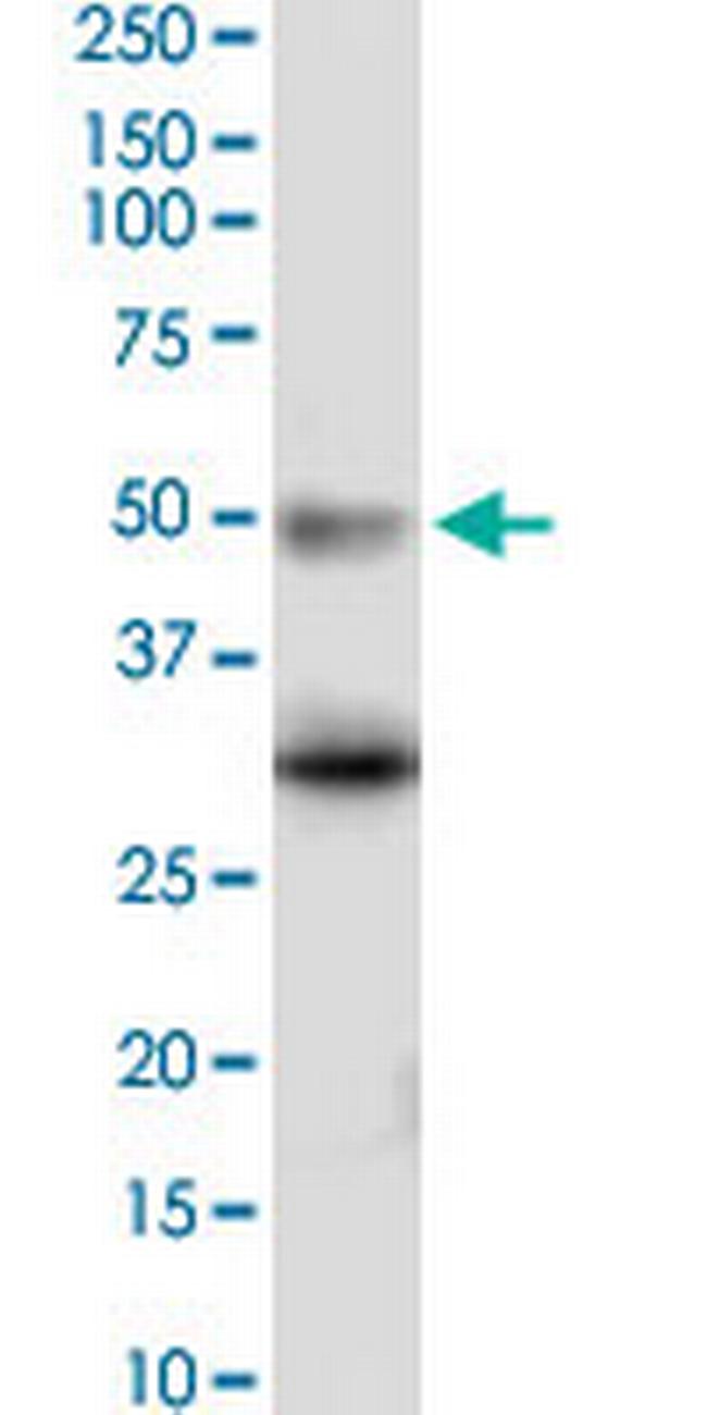 HTR5A Antibody in Western Blot (WB)