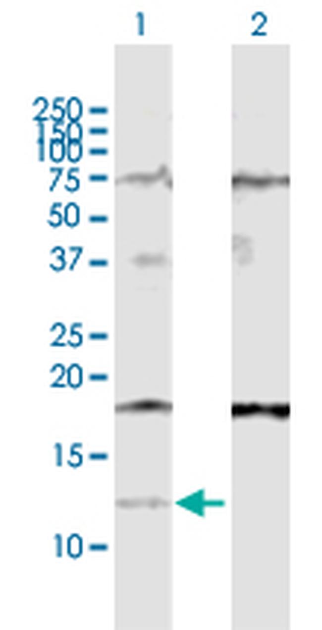 IFI27 Antibody in Western Blot (WB)