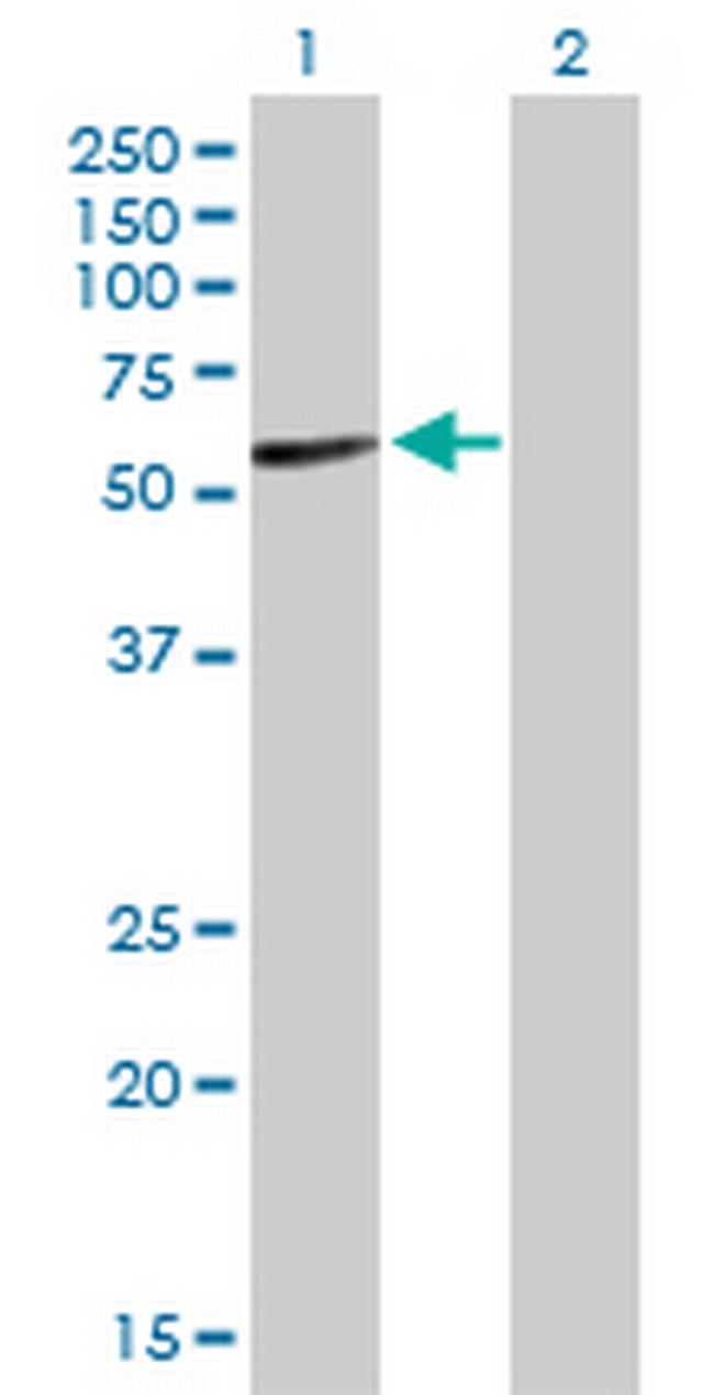 IGHA2 Antibody in Western Blot (WB)