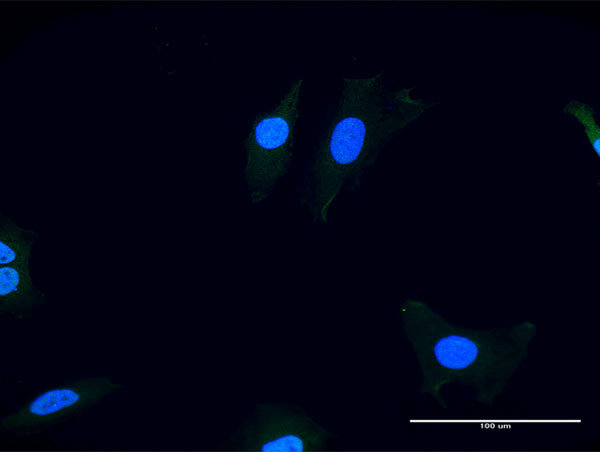 ITGAV Antibody in Immunocytochemistry (ICC/IF)