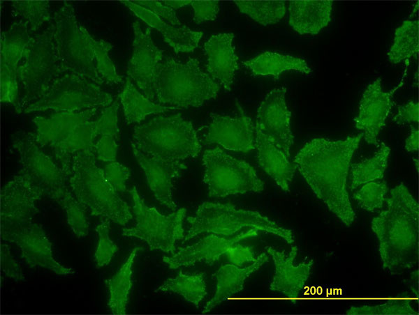 KRAS Antibody in Immunocytochemistry (ICC/IF)