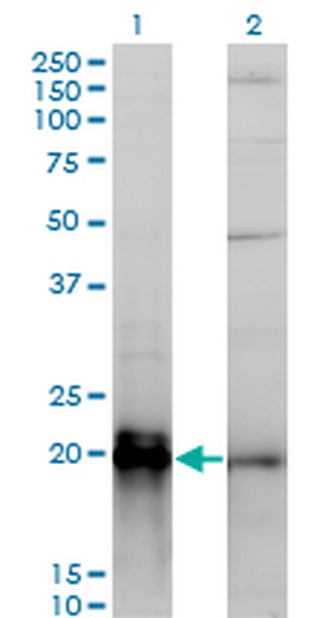 KRAS Antibody in Western Blot (WB)